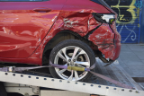 Can You Get Whiplash from a Minor Car Accident?